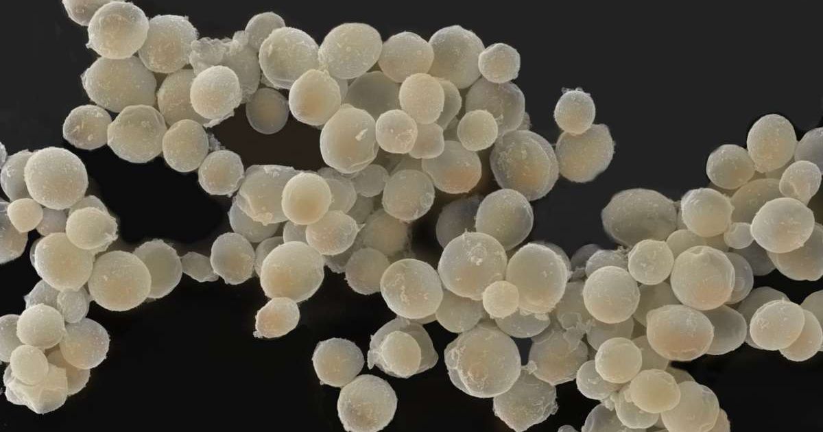 Baking yeast cells. Scanning electron microscopy. Yeast is used in brewing and baking to ferment sugars into useful products (Representative Cover Image Source: Getty | David Spears FRPS ASIS FRMS)