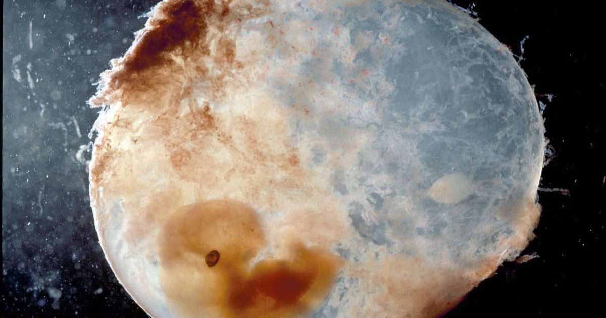 Human embryo enclosed in the amniotic sac during the fifth week of development. (Representative Cover Image Source: Art Images via Getty Images)