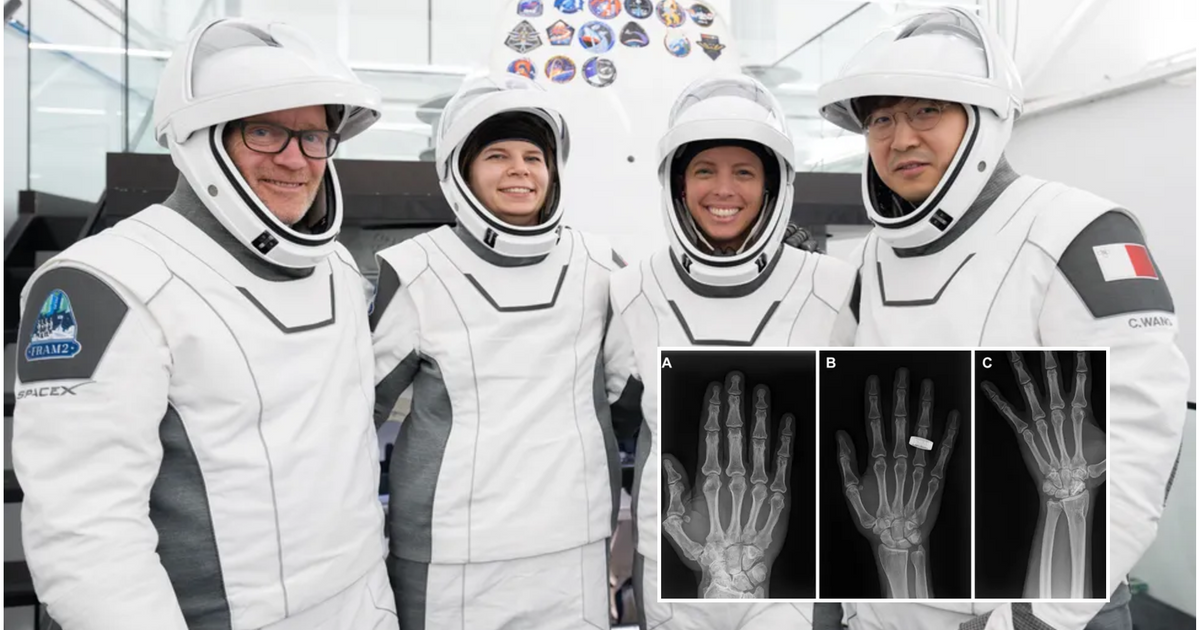 X-ray images taken during the Fram2 mission could change how astronaut health is monitored in space