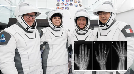 X-ray images taken during the Fram2 mission could change how astronaut health is monitored in space