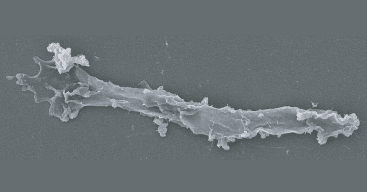 Scanning electron microscopy (SEM) of I. cascadensis in amoebiform. (Image Source: H. Beryl Rappaport, et al. )