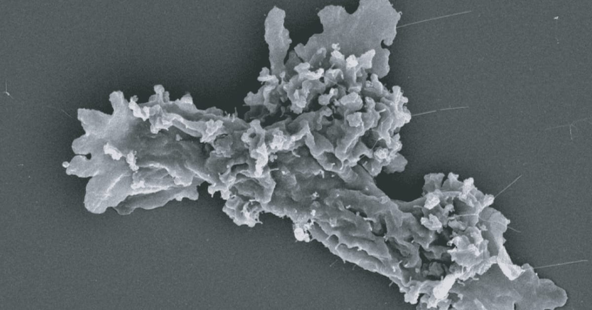 Scanning electron microscopy (SEM) of I. cascadensis in amoebiform state. [Cover Image Source: Rappaport et al. (2026). DOI: 10.1016/j.cell.2026.08.043]