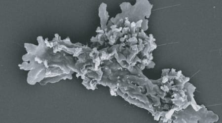Scientists have discovered new heat-resistant amoeba—and it could help find alien life